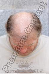 Hair Man White Overweight Bald